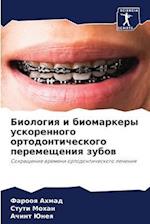 Biologiq i biomarkery uskorennogo ortodonticheskogo peremescheniq zubow
