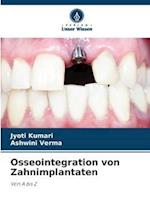 Osseointegration von Zahnimplantaten