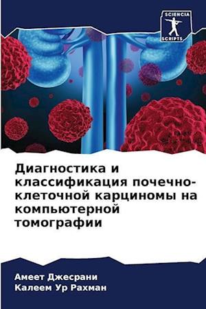 Diagnostika i klassifikaciq pochechno-kletochnoj karcinomy na komp'üternoj tomografii