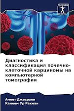 Diagnostika i klassifikaciq pochechno-kletochnoj karcinomy na komp'üternoj tomografii