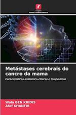 Metástases cerebrais do cancro da mama