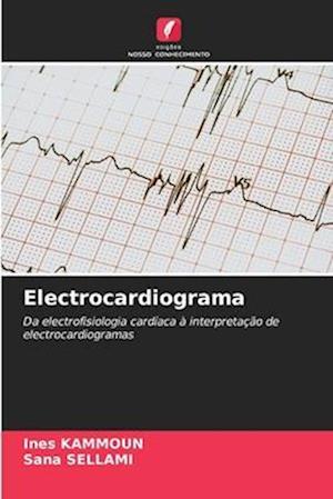 Electrocardiograma