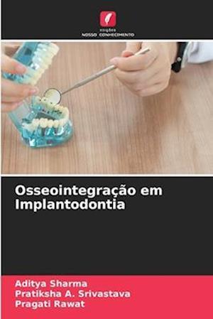 Osseointegração em Implantodontia