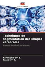 Techniques de segmentation des images cérébrales