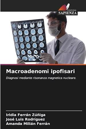 Macroadenomi ipofisari