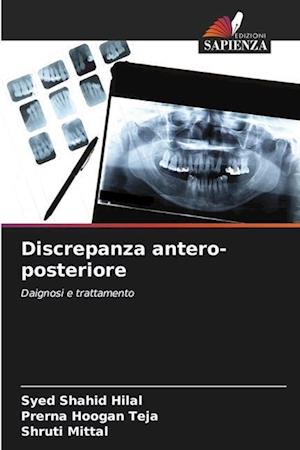 Discrepanza antero-posteriore