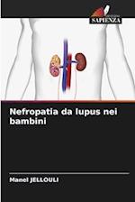 Nefropatia da lupus nei bambini