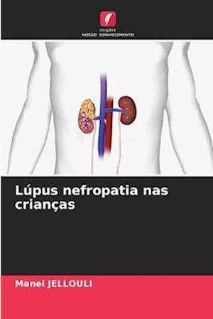 Lúpus nefropatia nas crianças