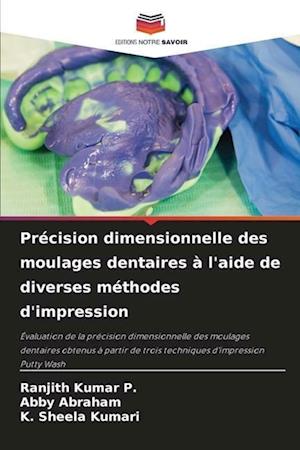 Précision dimensionnelle des moulages dentaires à l'aide de diverses méthodes d'impression