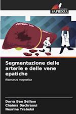 Segmentazione delle arterie e delle vene epatiche