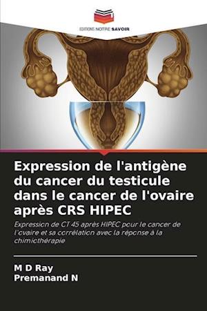 Expression de l'antigène du cancer du testicule dans le cancer de l'ovaire après CRS HIPEC