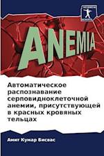 Awtomaticheskoe raspoznawanie serpowidnokletochnoj anemii, prisutstwuüschej w krasnyh krowqnyh tel'cah