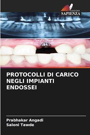 PROTOCOLLI DI CARICO NEGLI IMPIANTI ENDOSSEI