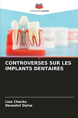 CONTROVERSES SUR LES IMPLANTS DENTAIRES