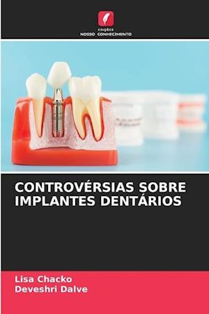 CONTROVÉRSIAS SOBRE IMPLANTES DENTÁRIOS