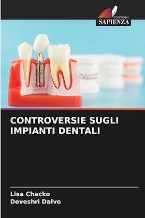 CONTROVERSIE SUGLI IMPIANTI DENTALI