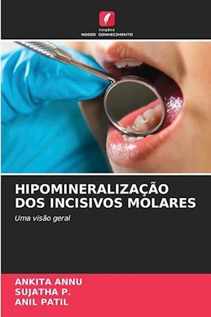 HIPOMINERALIZAÇÃO DOS INCISIVOS MOLARES