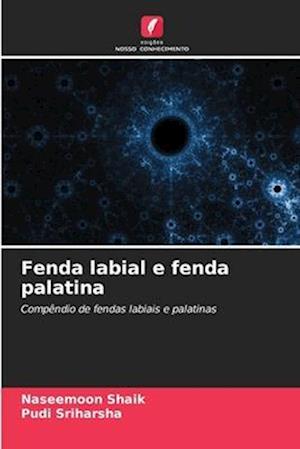 Fenda labial e fenda palatina