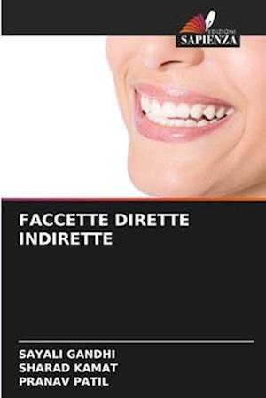 FACCETTE DIRETTE INDIRETTE