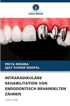 INTRARADIKULÄRE REHABILITATION VON ENDODONTISCH BEHANDELTEN ZÄHNEN