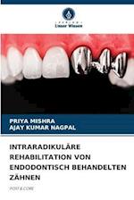 INTRARADIKULÄRE REHABILITATION VON ENDODONTISCH BEHANDELTEN ZÄHNEN