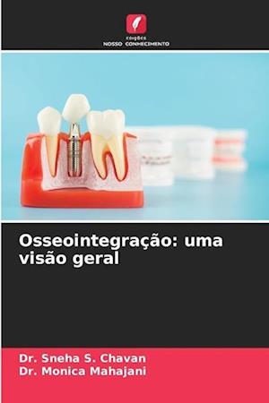 Osseointegração: uma visão geral