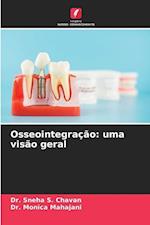 Osseointegração: uma visão geral