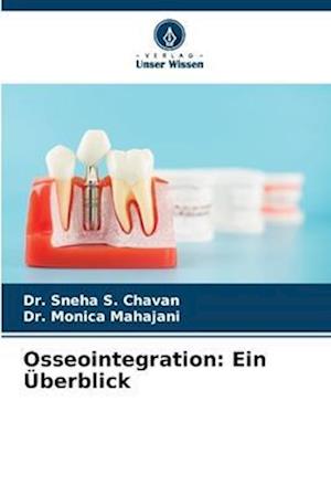 Osseointegration: Ein Überblick