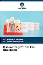 Osseointegration: Ein Überblick