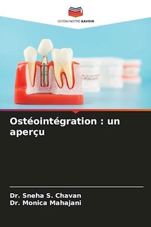 Ostéointégration : un aperçu