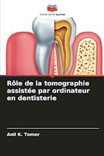 Rôle de la tomographie assistée par ordinateur en dentisterie