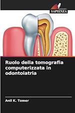 Ruolo della tomografia computerizzata in odontoiatria