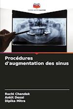 Procédures d'augmentation des sinus