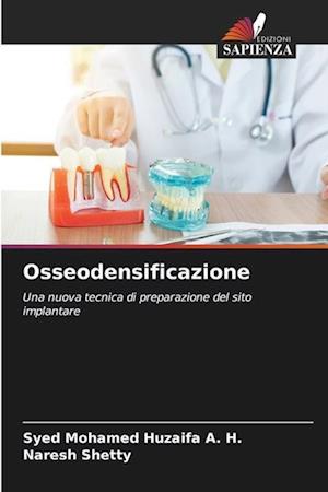 Osseodensificazione