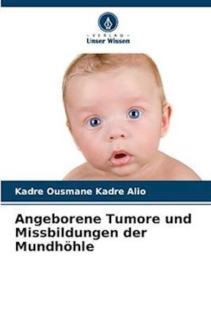 Angeborene Tumore und Missbildungen der Mundhöhle