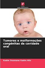 Tumores e malformações congénitas da cavidade oral