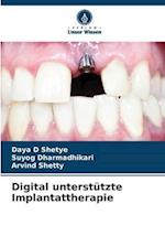 Digital unterstützte Implantattherapie