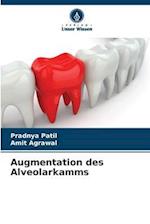 Augmentation des Alveolarkamms