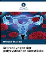 Erkrankungen der polyzystischen Eierstöcke