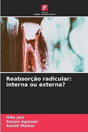 Reabsorção radicular: interna ou externa?