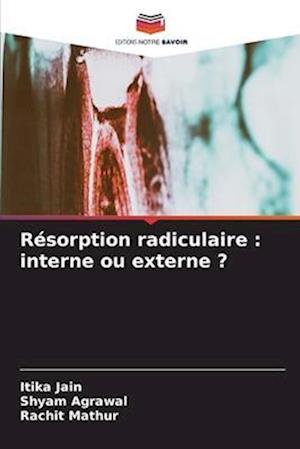 Résorption radiculaire : interne ou externe ?