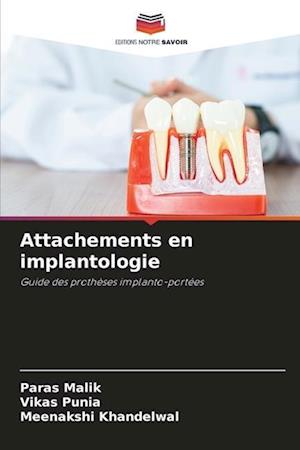 Attachements en implantologie