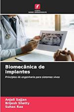 Biomecânica de implantes