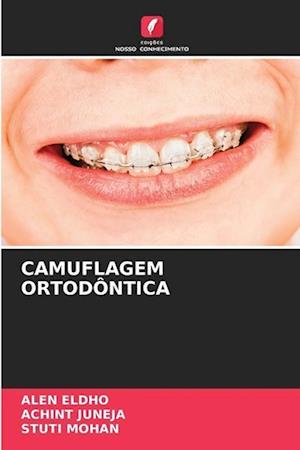 Camuflagem Ortodôntica