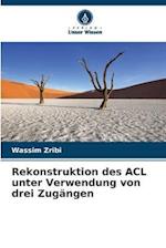 Rekonstruktion des ACL unter Verwendung von drei Zugängen