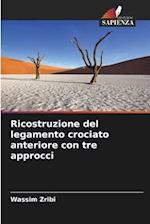 Ricostruzione del legamento crociato anteriore con tre approcci