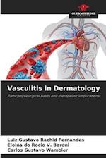 Vasculitis in Dermatology 