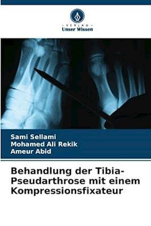 Behandlung der Tibia-Pseudarthrose mit einem Kompressionsfixateur