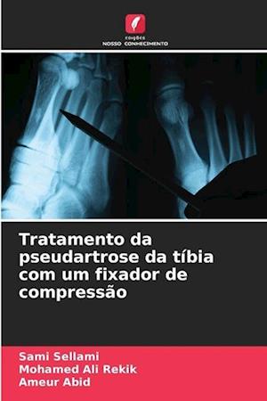 Tratamento da pseudartrose da tíbia com um fixador de compressão