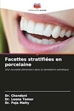 Facettes stratifiées en porcelaine